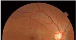 New 3D eye scan technology now at Sooke Optometry retina, eye health