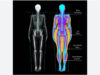 Body composition DEXA scanner at Camosun College DEXA scan