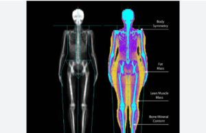 Body composition DEXA scanner at Camosun College DEXA scan