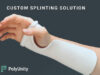 BC announces 3D-printed splints starting at Vancouver General Hospital PolyUnity, 3d splints